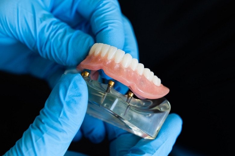 dental-prosthetics-in-turkiye https://disadasi.com.tr/wp-content/uploads/2025/08/dental-prosthetics-in-turkiye.jpg