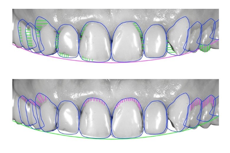 digital-smile-design https://disadasi.com.tr/wp-content/uploads/2025/08/digital-smile-design.jpg