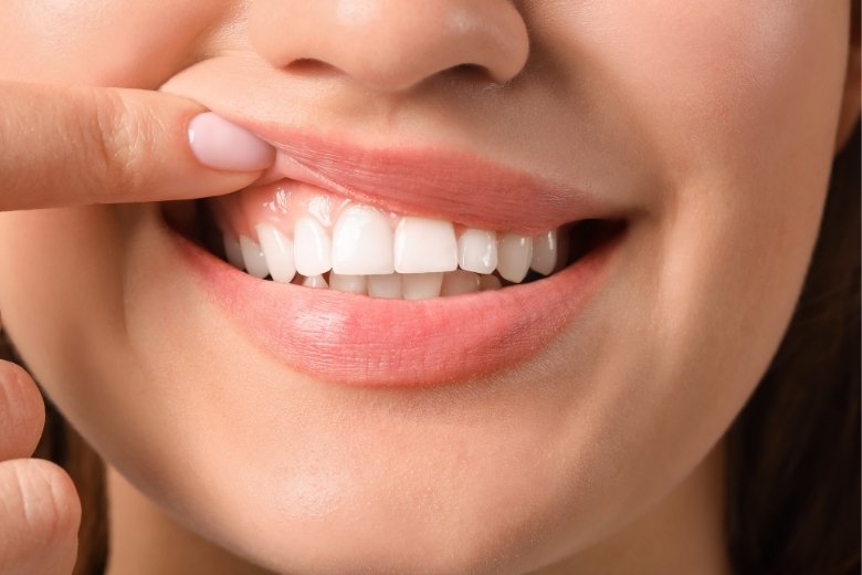 gum-treatments-kusadasi-turkiye-2 https://disadasi.com.tr/wp-content/uploads/2025/08/gum-treatments-kusadasi-turkiye-2.jpg