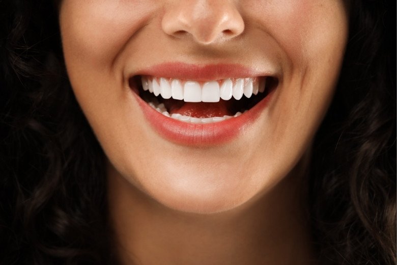 laminate-veneers https://disadasi.com.tr/wp-content/uploads/2025/08/laminate-veneers.jpg